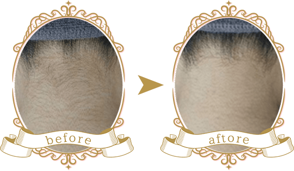 ビフォーアフター