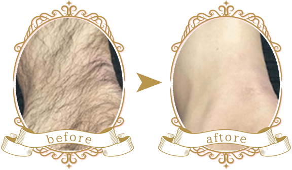 ビフォーアフター