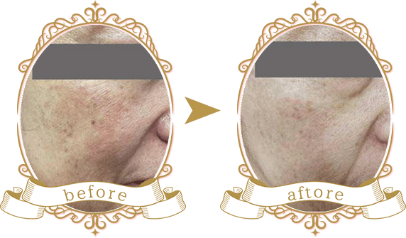 ビフォーアフター